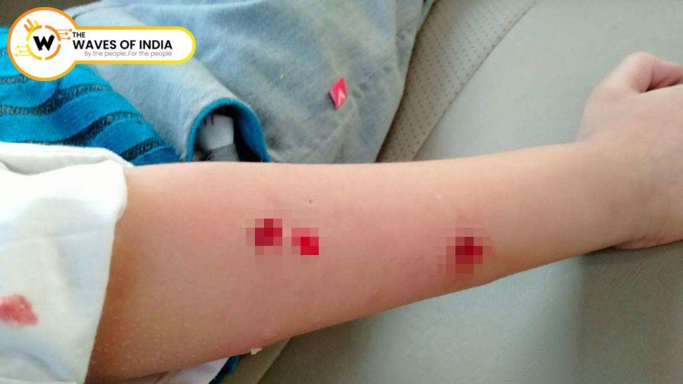 नोएडा में पालतू कुत्ते ने बच्चे को काटा, मालिक पर 10 हजार रुपये का जुर्माना